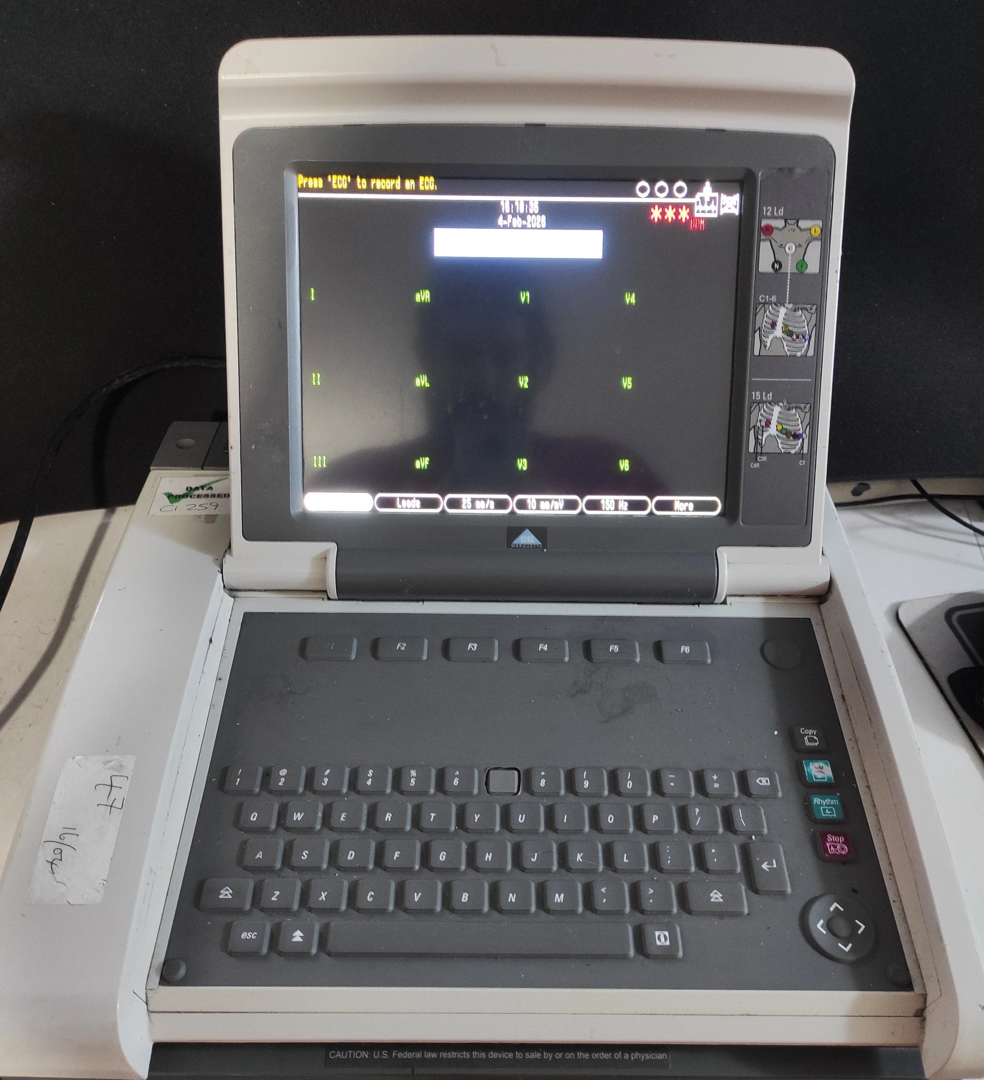 GE MAC 5500 HD Resting ECG Machine with Color Display Electrocardiogram System